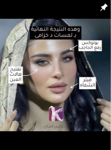 Frame 427321928
