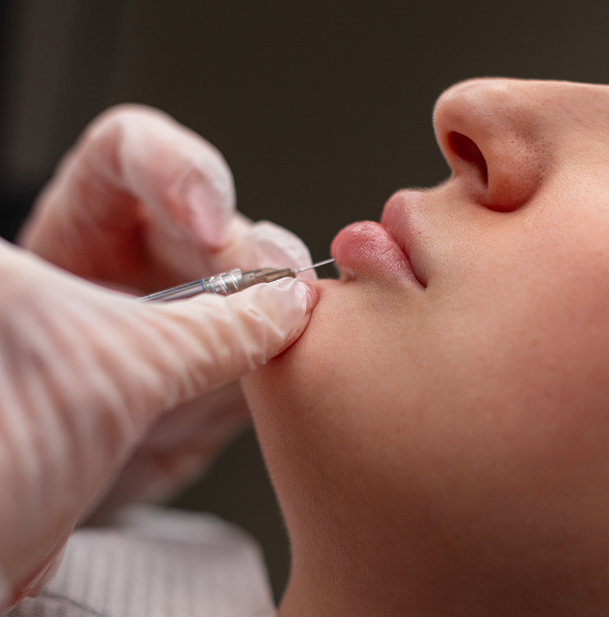 Premium dermal filler brands including Juvederm and Restylane used for lip enhancement treatments in Riyadh