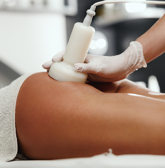 Cellulite treatment