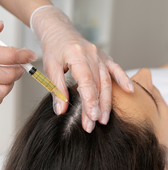 PRP therapy (Platelet-Rich Plasma)