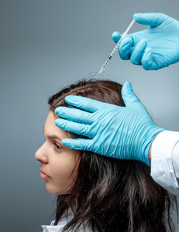 Hair Loss Treatment