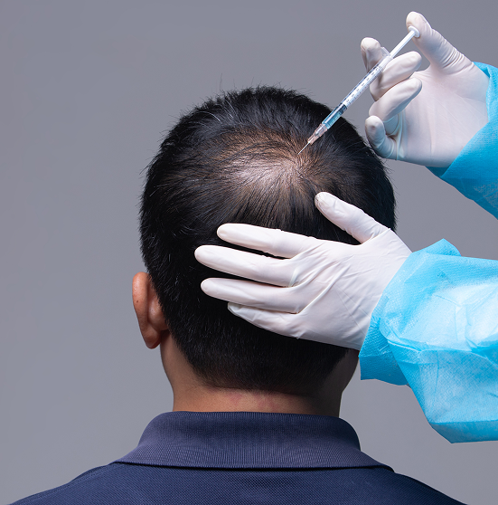 Hair loss Treatment