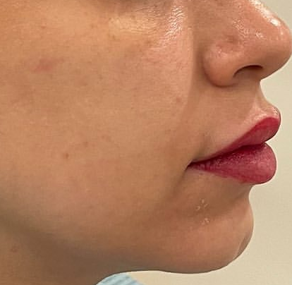 Dermatologist in Riyadh