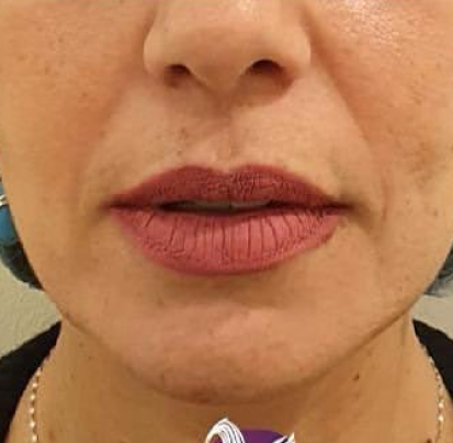 Dermatologist in Riyadh