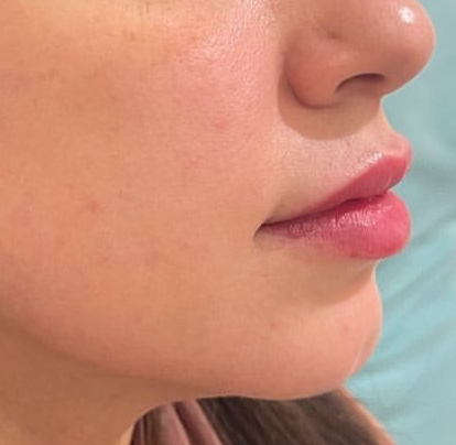 Dermatologist in Riyadh