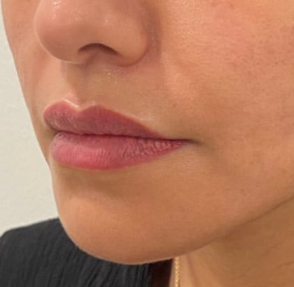 Dermatologist in Riyadh