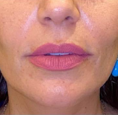 Dermatologist in Riyadh