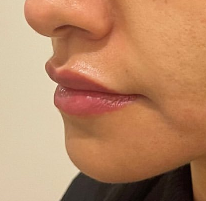 Dermatologist in Riyadh