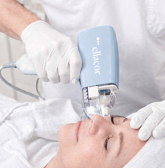 Micro-coring for skin volume reduction