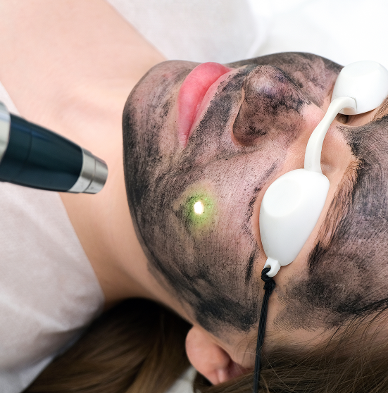 Gentle Laser Facial/Pore Cleansing