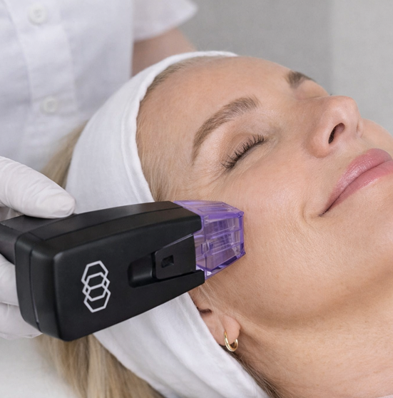 Radiofrequency Needle Tightening