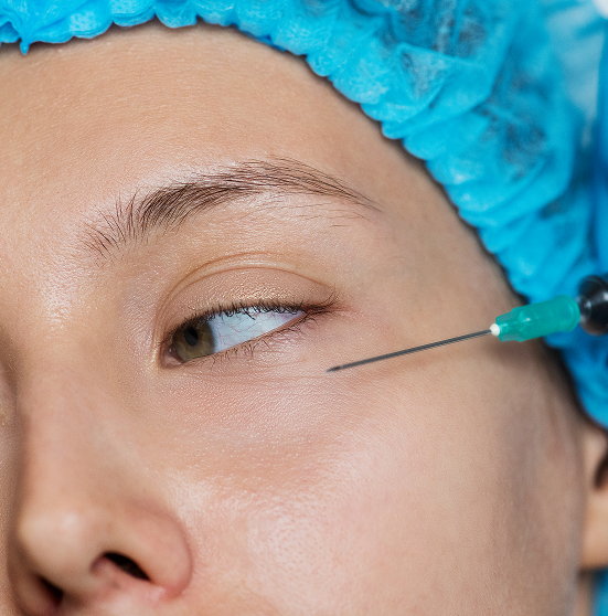 Under-Eye Fillers