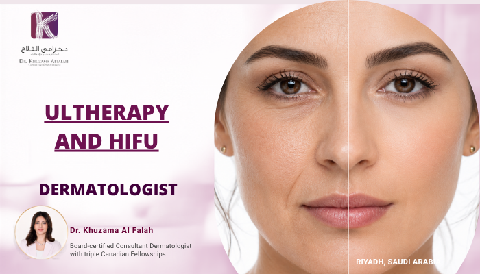 Ultherapy vs HIFU