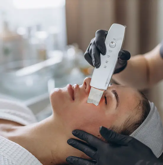 Microneedling with Exosomes