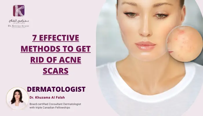 Dermatologist promoting acne scar treatments.
